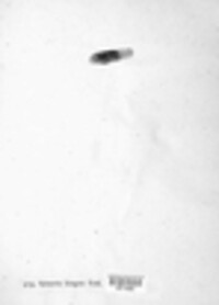 Leptosphaeria maculans image